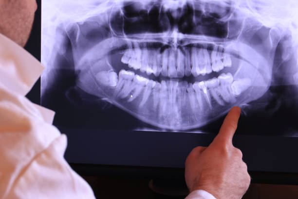 Best Urgent Dental Care for Toothaches in Franklinville, NC