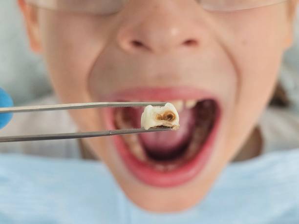 Best Walk-In Emergency Dental Services in Franklinville, NC